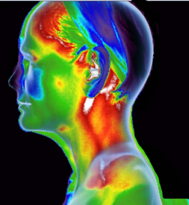 Thermography System at Amchara Resort