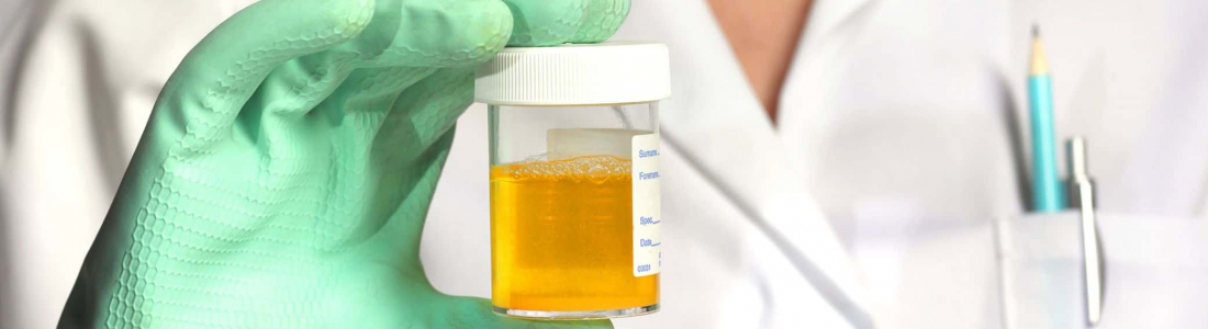 Urinalysis - Bioscint