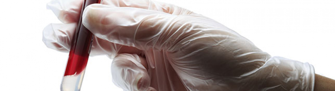 6 Essential Blood Tests You Should Have 6 Essential Blood Tests You Should Have